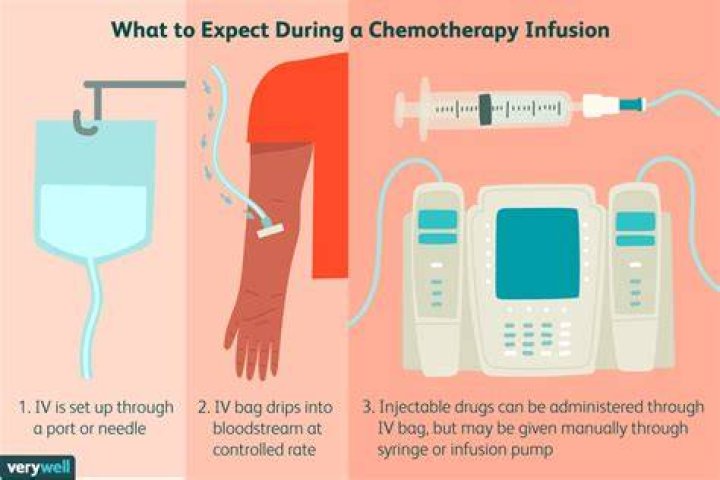 5 Ways To Chemotherapy Infusion Coding Cheat Sheet 20 vrogue.co