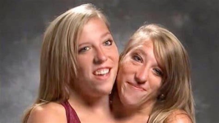 Abby And Brittany Hensel Finally Talks About Sex Life
