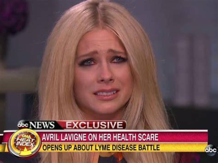 Avril Lavigne on Lyme Disease ‘I Had Accepted That I Was Dyingâ