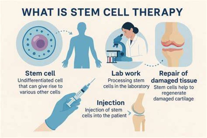 CMCells Stem Cell Treatment in Juarez Mexico