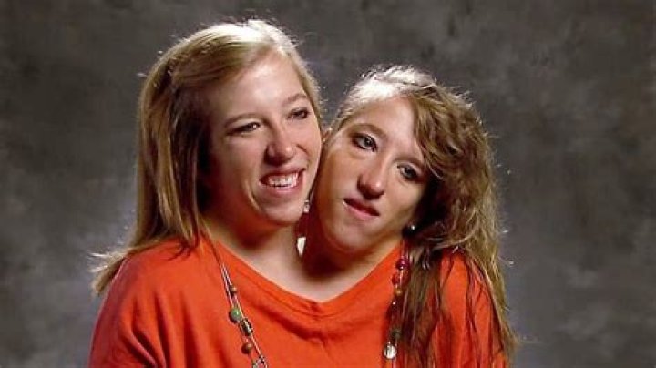 DETAILS Are Abby And Brittany Hensel Married?