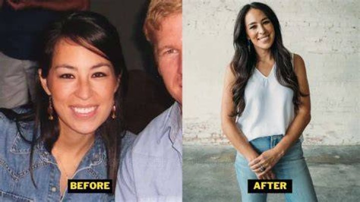 Did Joanna Gaines Have Plastic Surgery? Everything You Need To Know!