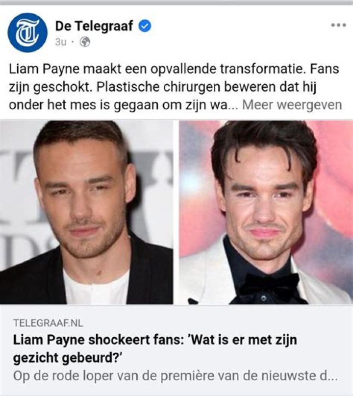 Door plastische chirurgie verspookte celebs 35 Celebs en
