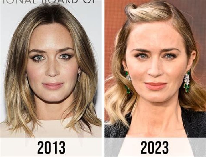Emily Blunt Before and After From 2004 to 2024 The Skincare Edit