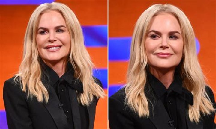 Has Nicole Kidman had cosmetic surgery? Celebrity