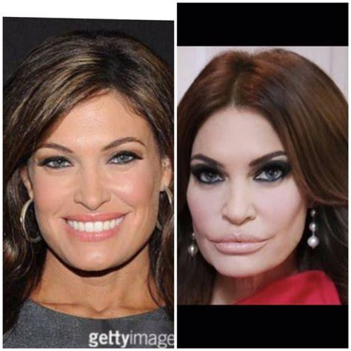 Kimberly Guilfoyle’s Before Plastic Surgery Pictures Uncovered
