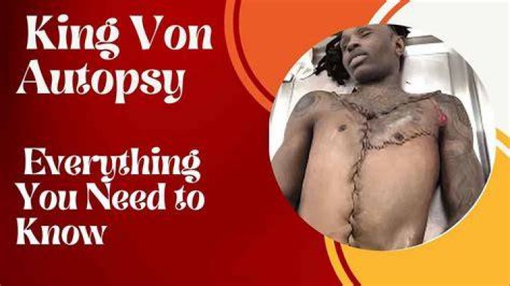 King Von autopsy dead The Music World is Shocked