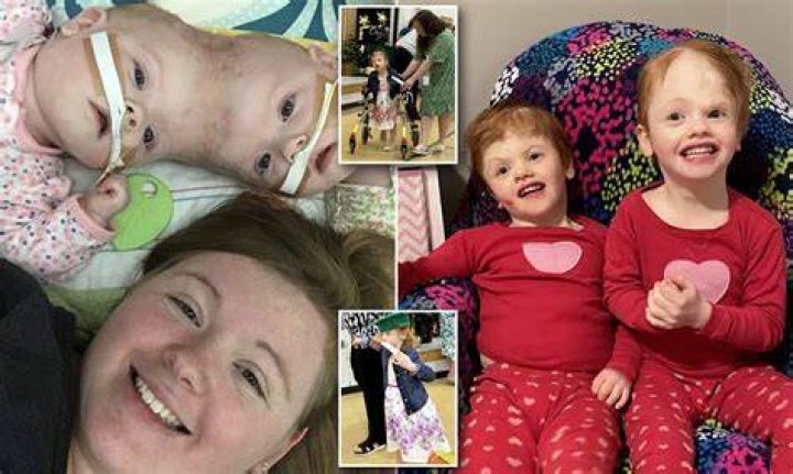 New details of conjoined twins Abby and Brittany Hensel&rsquo;s wedding day