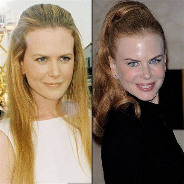 Nicole Kidman at 44 How Her Face Has Changed Us Weekly