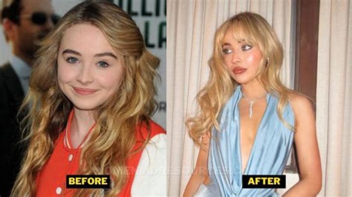 Sabrina Carpenter Plastische Chirurgie VorherNachher Fotos