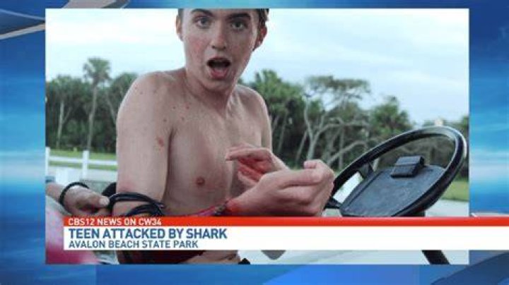 SharkBanz investigates local teen's rare attack wearing shark repelling