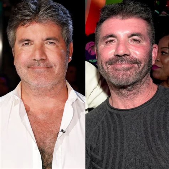 Simon Cowell Removes His Face Fillers After Saying He Went &ldquo;Too Far&rdquo;