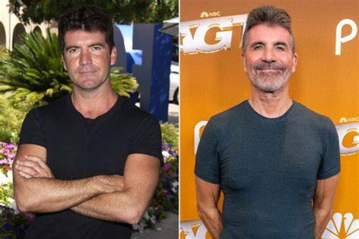 Simon Cowell Undergoes Emergency Surgery After Breaking His Back