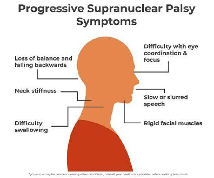 What is PSP disease? Symptoms explored in wake of Billy Miller death claim