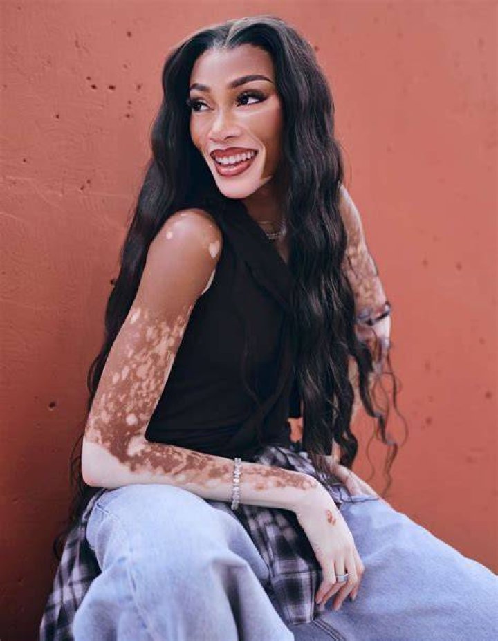 Winnie Harlow Opens Up About Early Days of Dating Kyle Kuzma